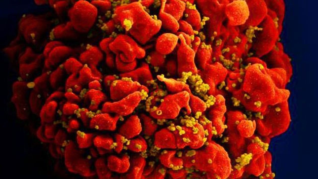 Brain Cells Act as a Harbor for HIV