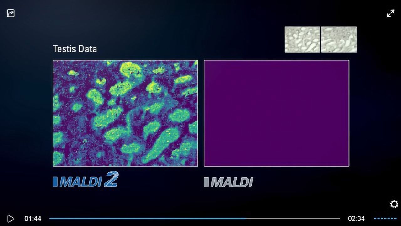 Introducing the MALDI-2 on timsTOF fleX: MALDI-2, redefining ionization for >100x increased signal a