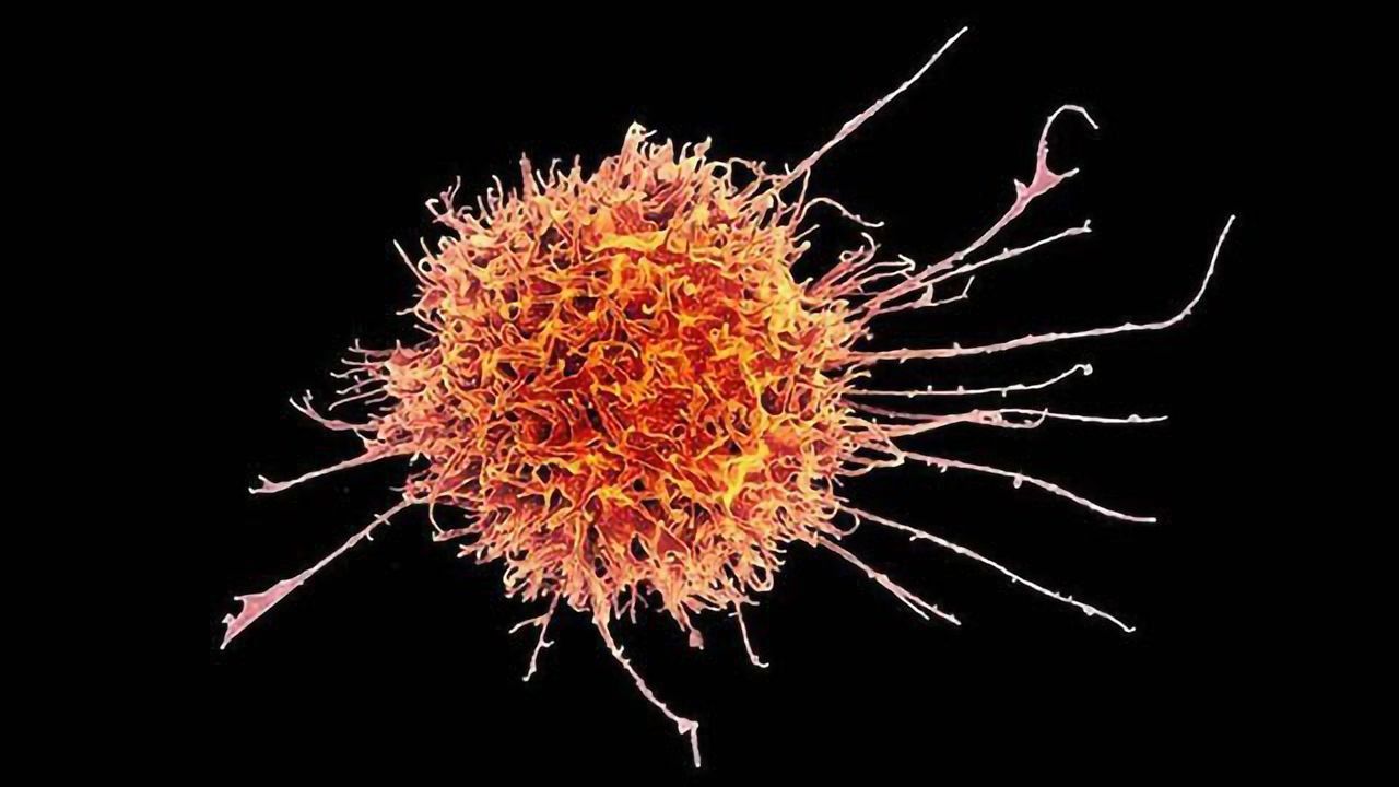 Natural Killer Cell