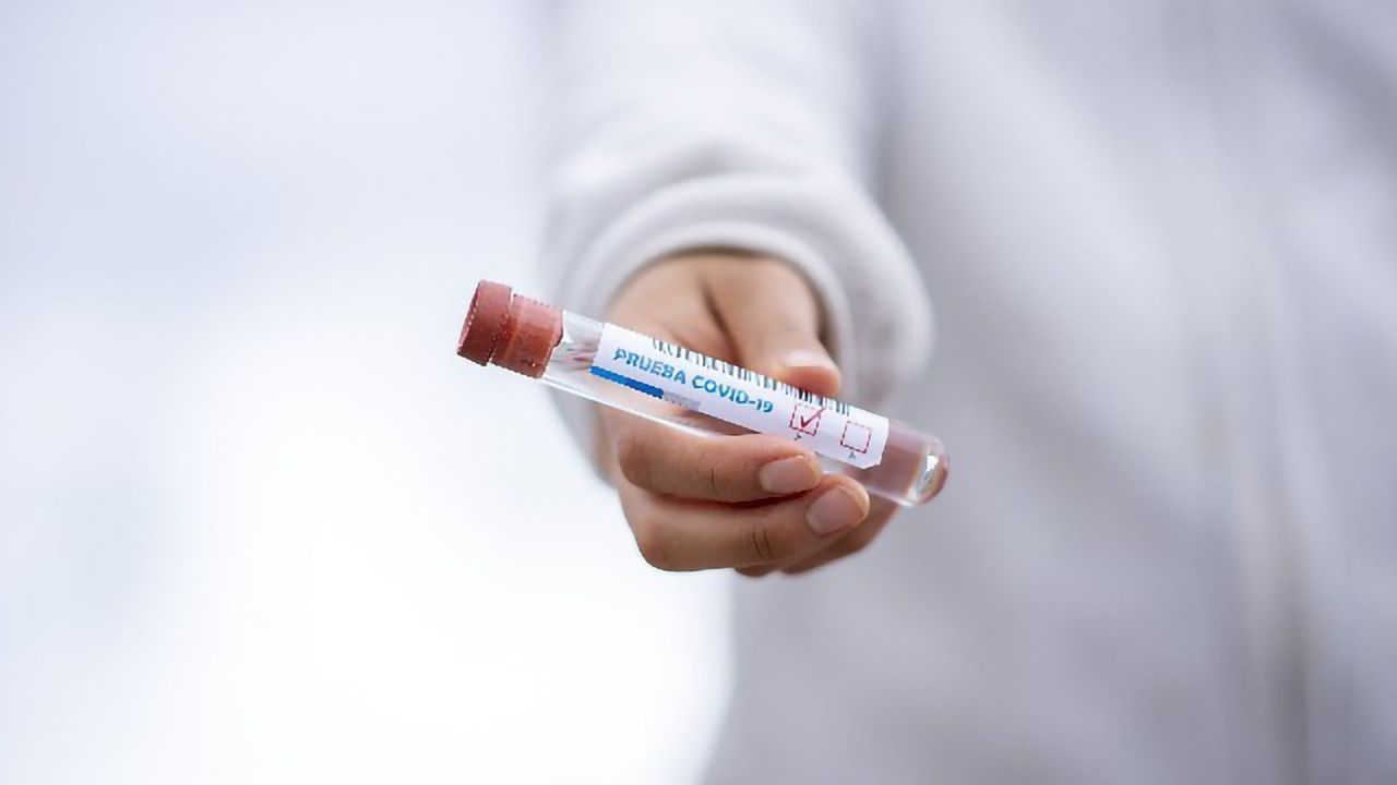 Researchers Create a New Type of COVID-19 Antibody Test