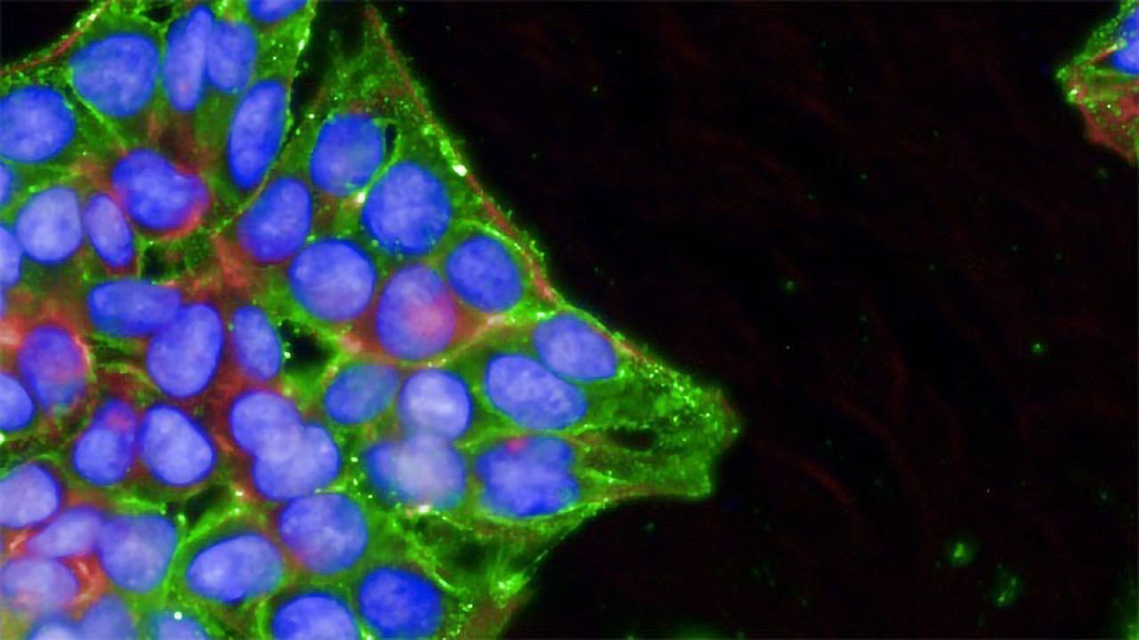 Screening for Novel Inhibitors of SARS-CoV-2