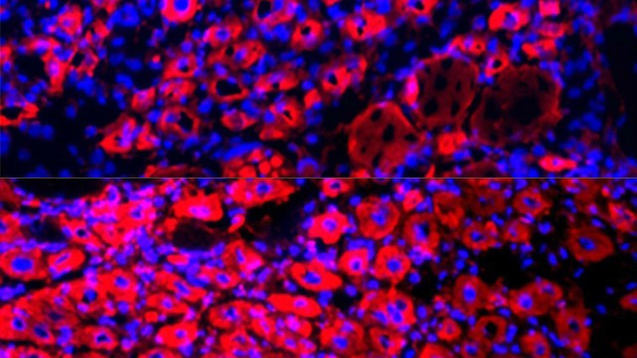 Diluting Blood Plasma Reverses Aging and Rejuvenates Tissue