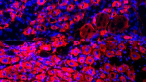 Diluting Blood Plasma Reverses Aging and Rejuvenates Tissue