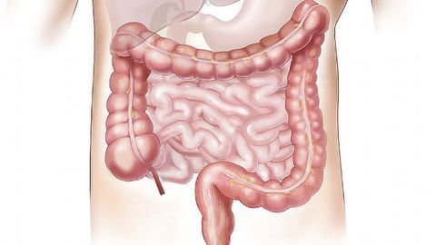 Drivers of Healthy Gut Maintenance Uncovered