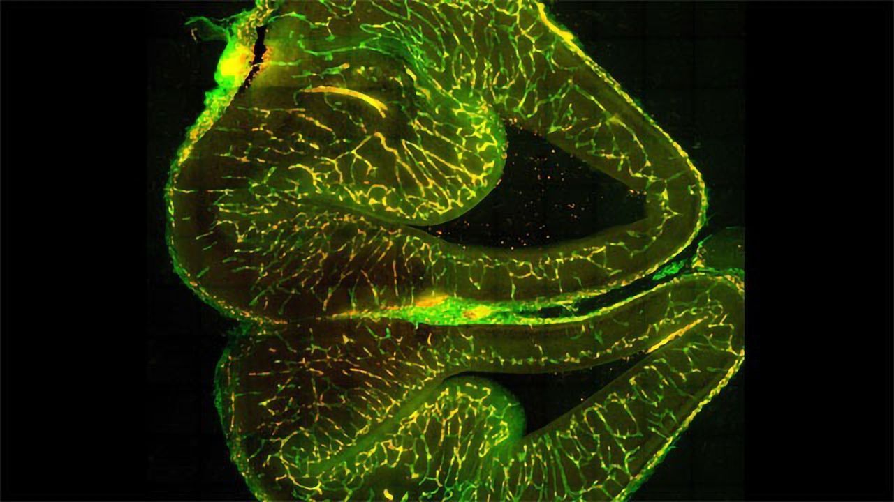 Vascular Cell Development in the Brain