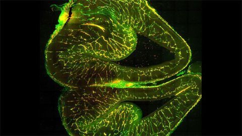 Vascular Cell Development in the Brain