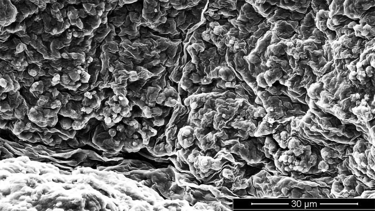 Extracellular Matrix