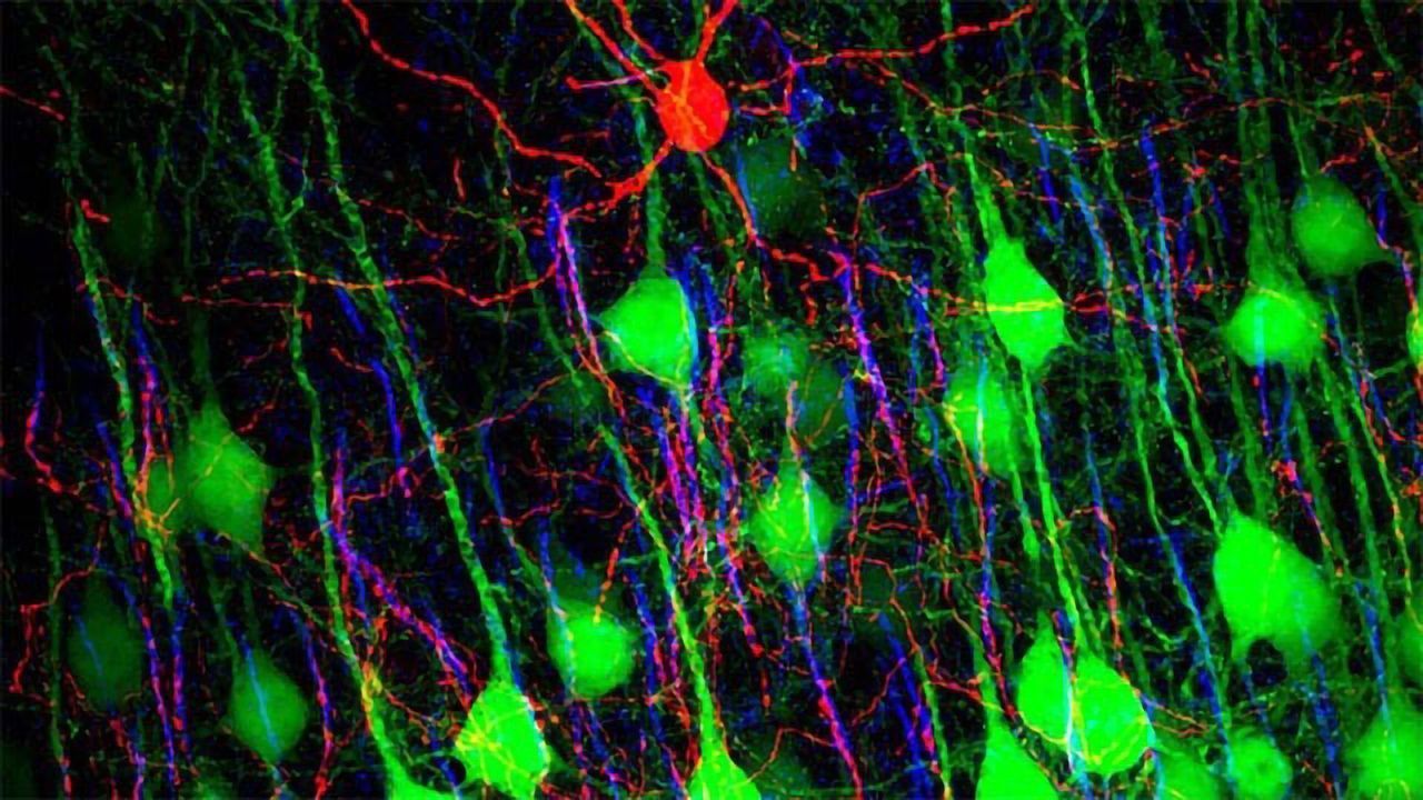 Chandelier Cell and Pyramidal Neurons