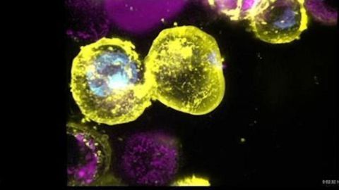 New Light Shone on Inflammatory Cell Death Regulator