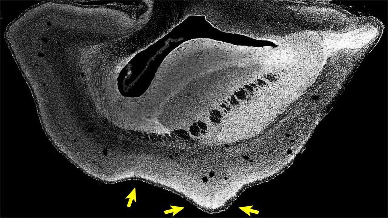 Human-Specific Gene Causes a Larger Neocortex in Monkeys