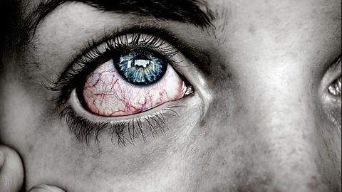 Clinician-Scientists Identify "Pink Eye" as Possible Primary Symptom of COVID-19