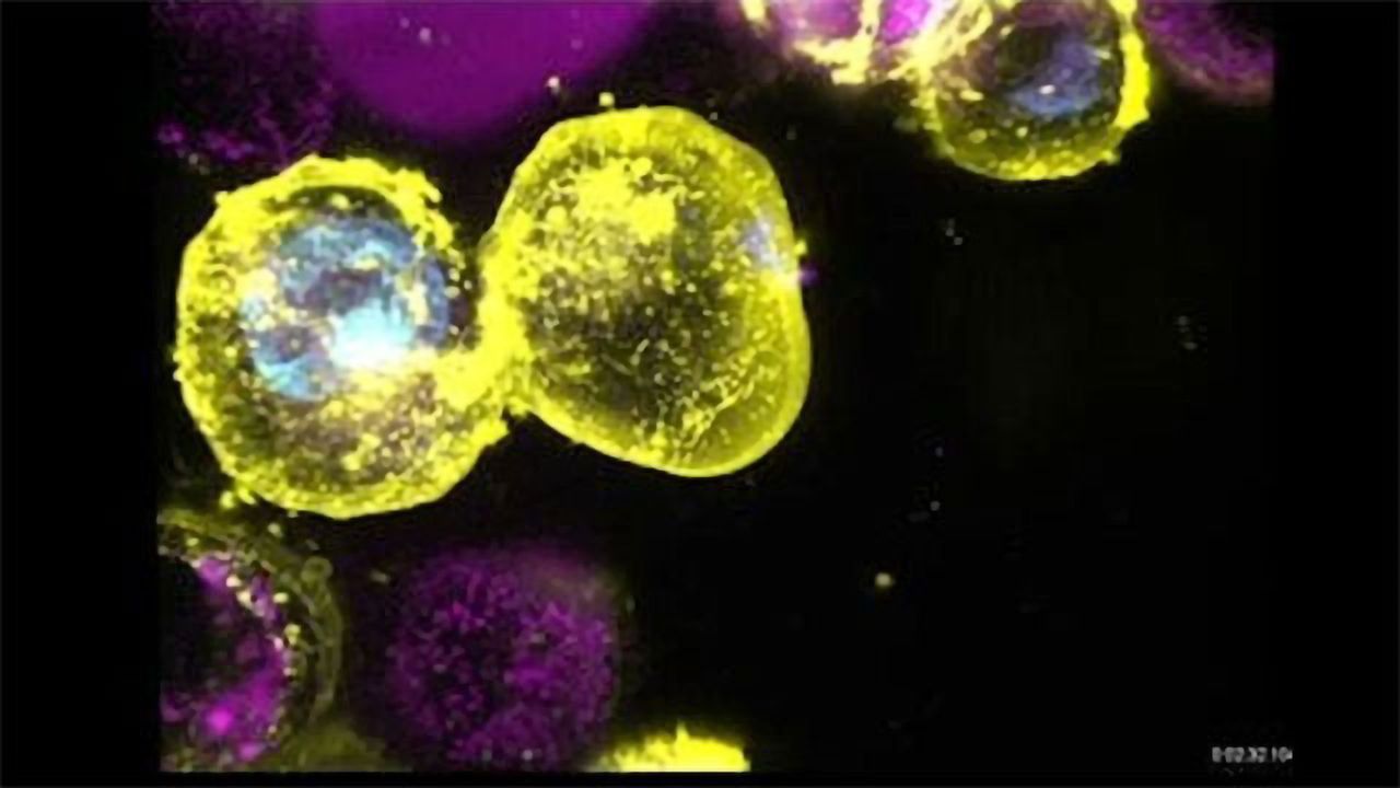 Cell Death by Necroptosis