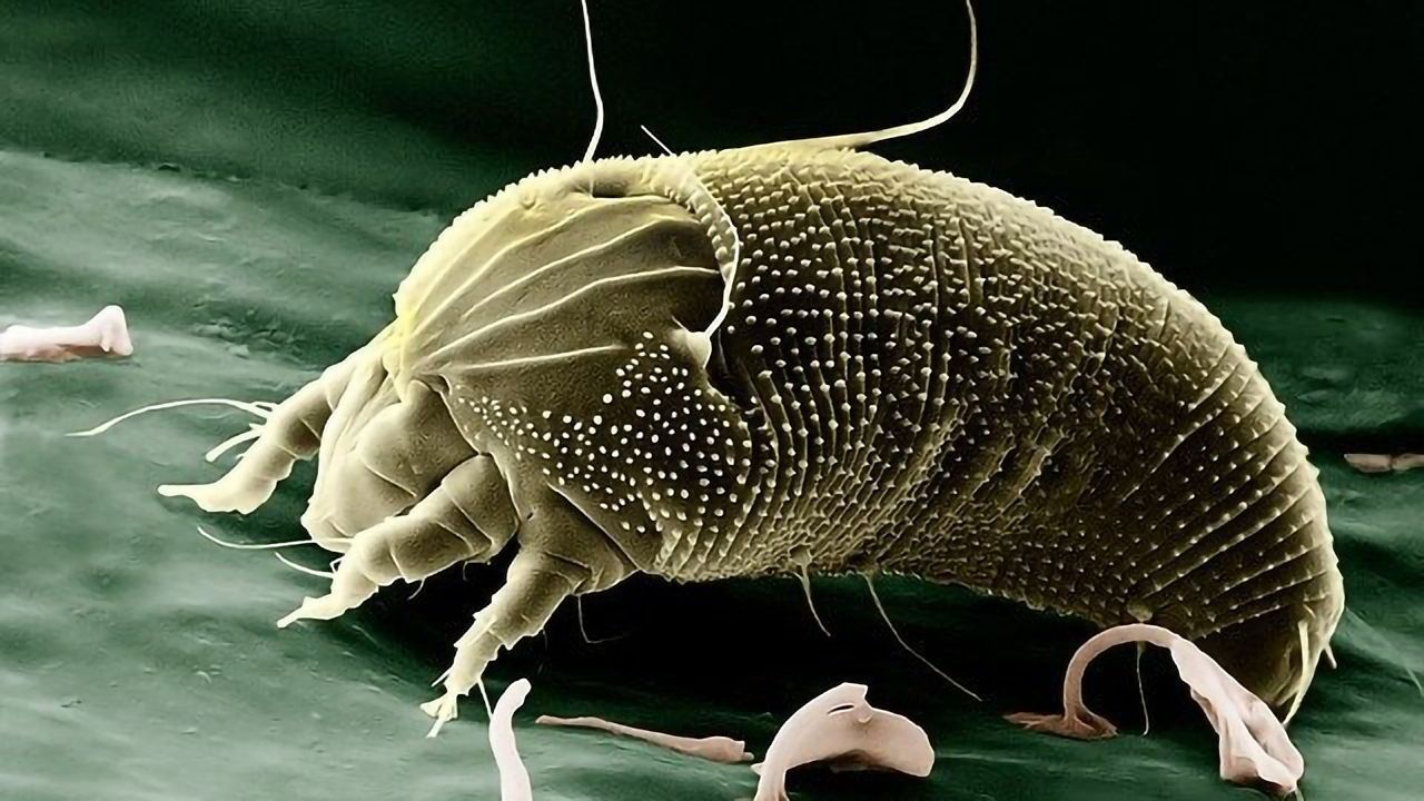 Pulmonary Immune System Triggered by Dust Mite Allergens