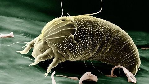 Pulmonary Immune System Triggered by Dust Mite Allergens