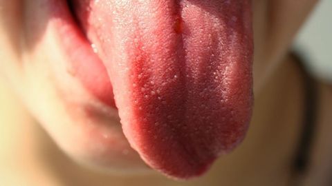 Tongue Microbes Could Provide Window to Heart Health