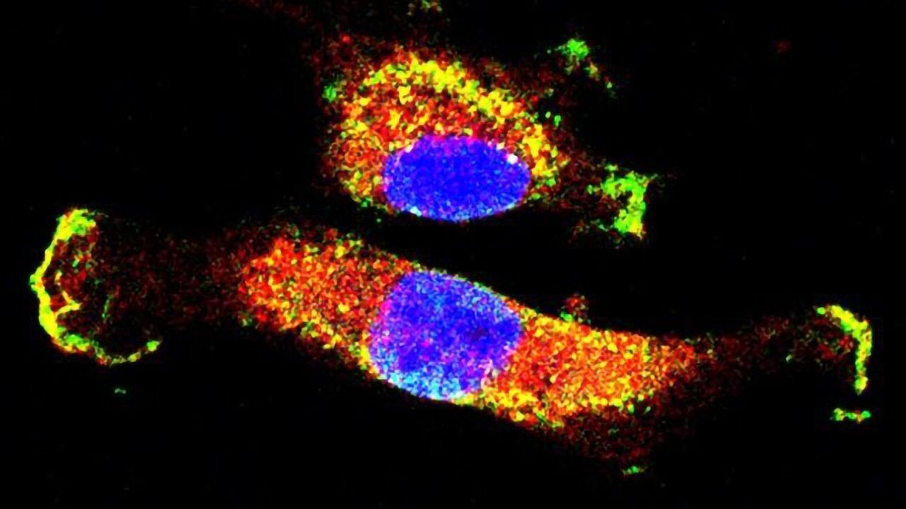 Unraveling the Circuitry Controlling Cancer's Spread