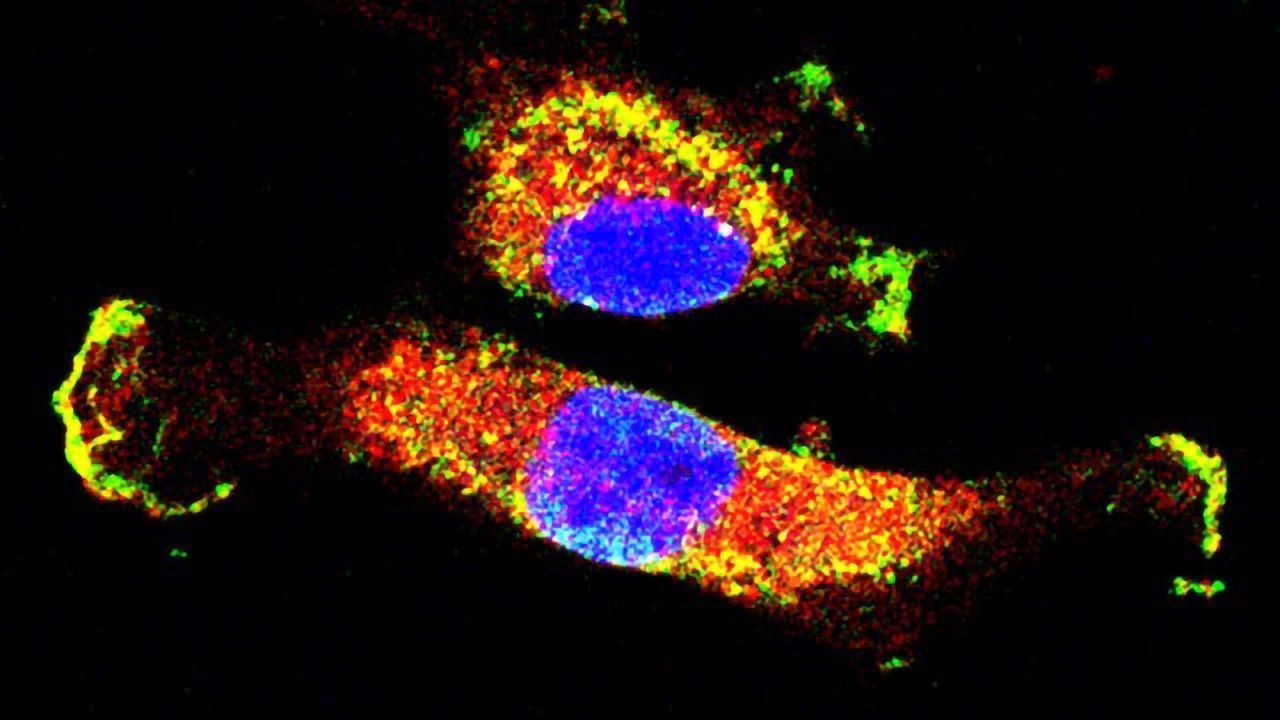 Interactions Behind Cancer Cell Spread