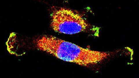 Interactions Behind Cancer Cell Spread