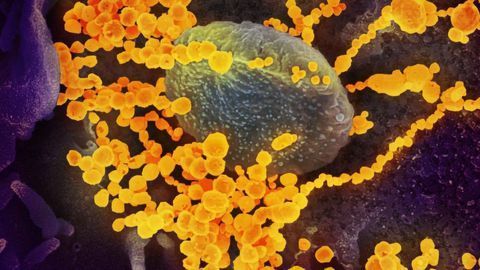 Experts Identify Steps To Expand and Improve Antibody Tests in COVID-19 Response
