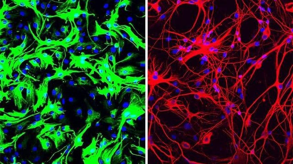 One-Time Treatment Generates New Neurons, Eliminates Parkinson’s Disease in Mice content piece image