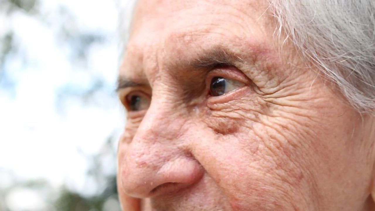 More Severe Alzheimer's Subtype May Be Caused by Tau Modifications