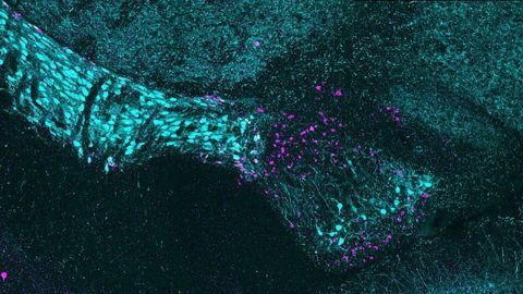 Researchers Unravel the Cellular Structure of a Little-understood Visual Brain Region