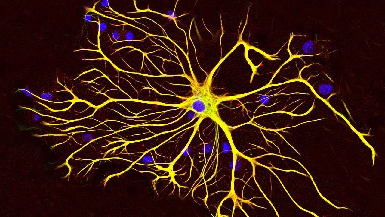 Astrocytes May Play a Driving Role in Glaucoma