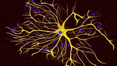 Astrocytes May Play a Driving Role in Glaucoma
