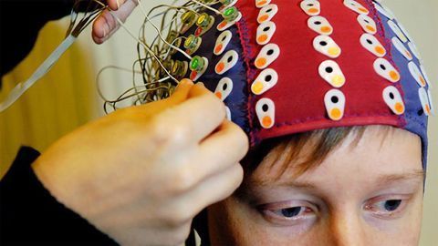The Dyslexic Brain Struggles in Processing Variation in Speech