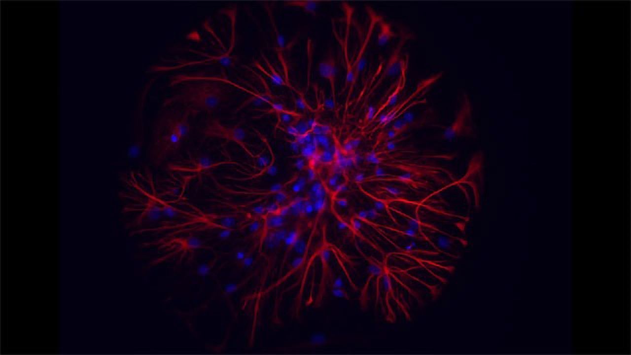 Could Gold Nanoparticles Save Neurons From Cell Death?