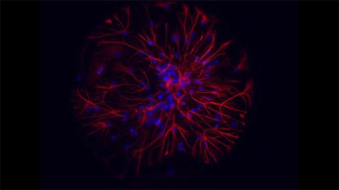 Neurons and Astrocytes