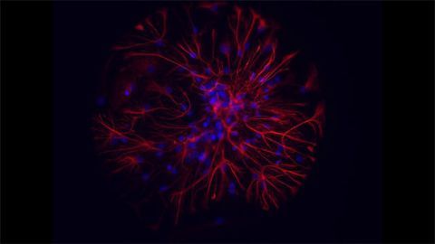 Neurons and Astrocytes