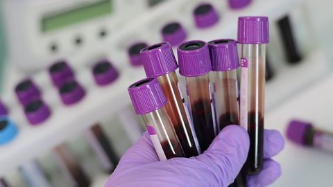 New Insights Into the Ex Vivo Expansion of Transplantable Human Blood Stem Cells