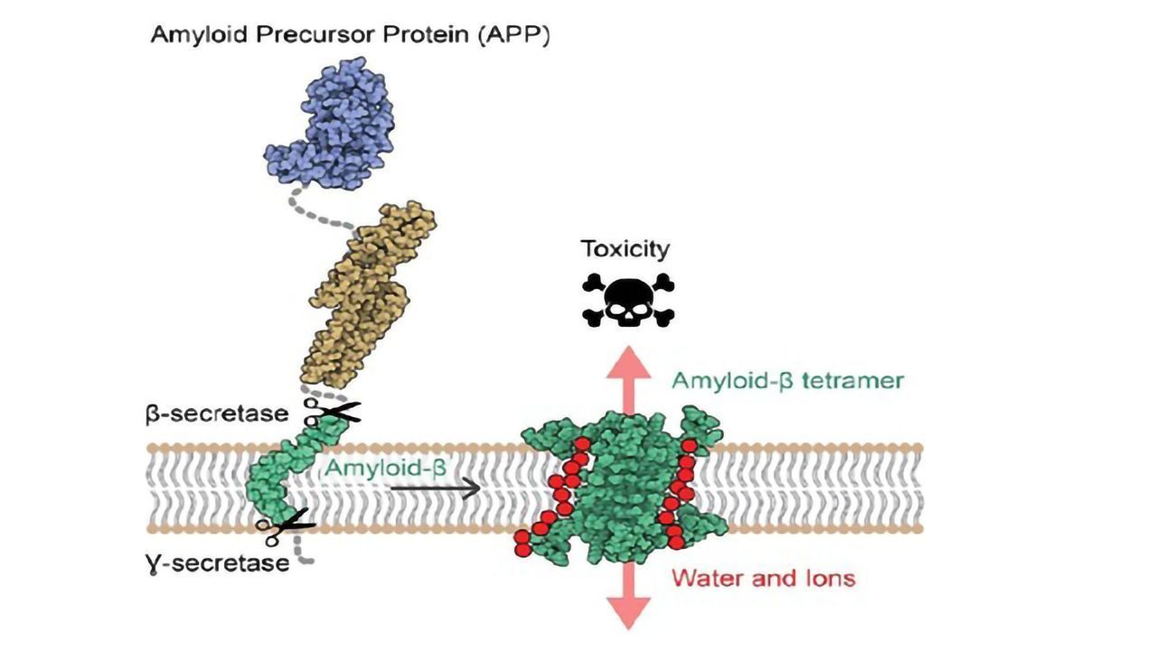 Atomic Structure of Aβ Protein Assemblies Revealed