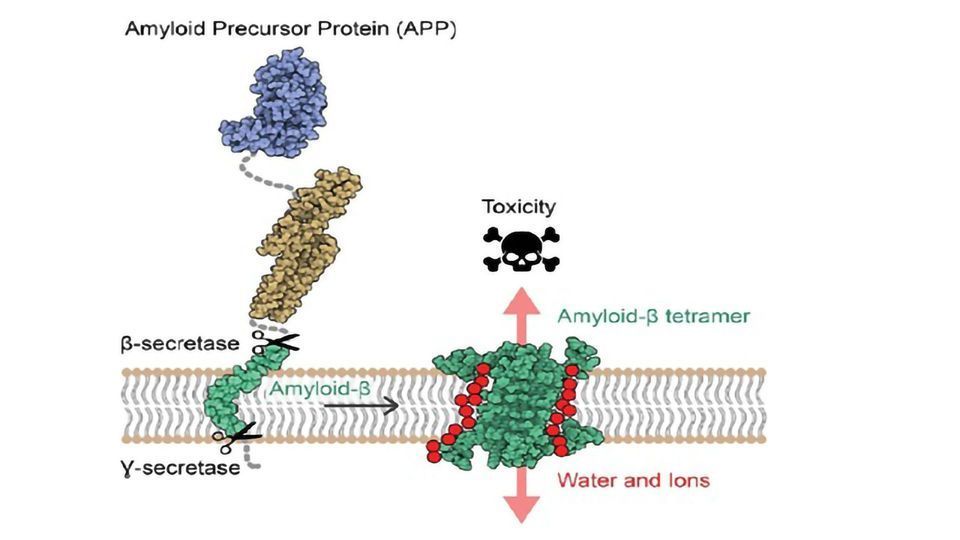 Atomic Structure of Aβ Protein Assemblies Revealed content piece image