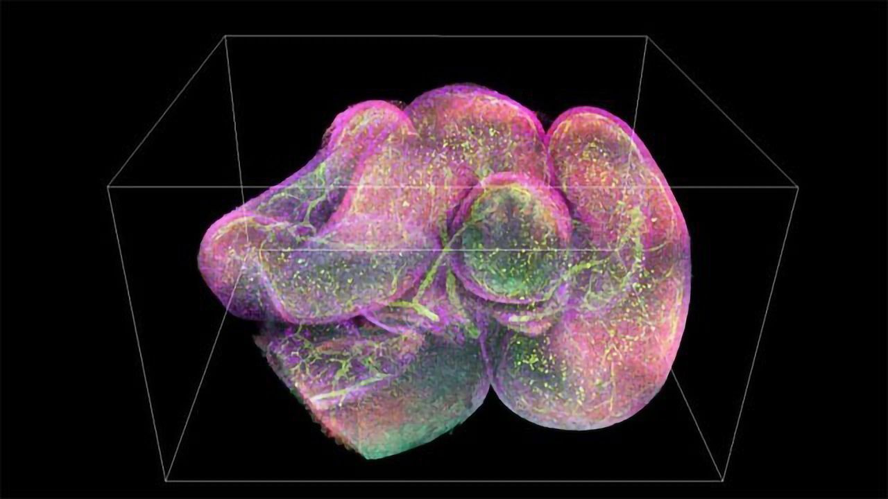 Cutting-edge Fluorescence Microscopy Is Made More Accessible