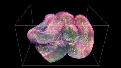 Cutting-edge Fluorescence Microscopy Is Made More Accessible