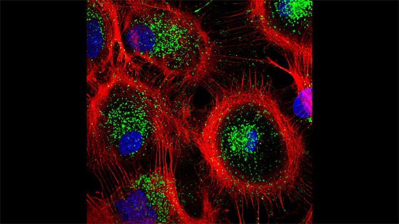 Mouse Astrocytes Preparing for Autophagy