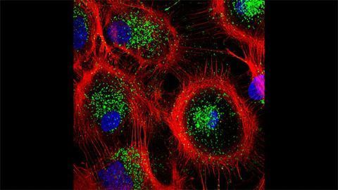 Mouse Astrocytes Preparing for Autophagy