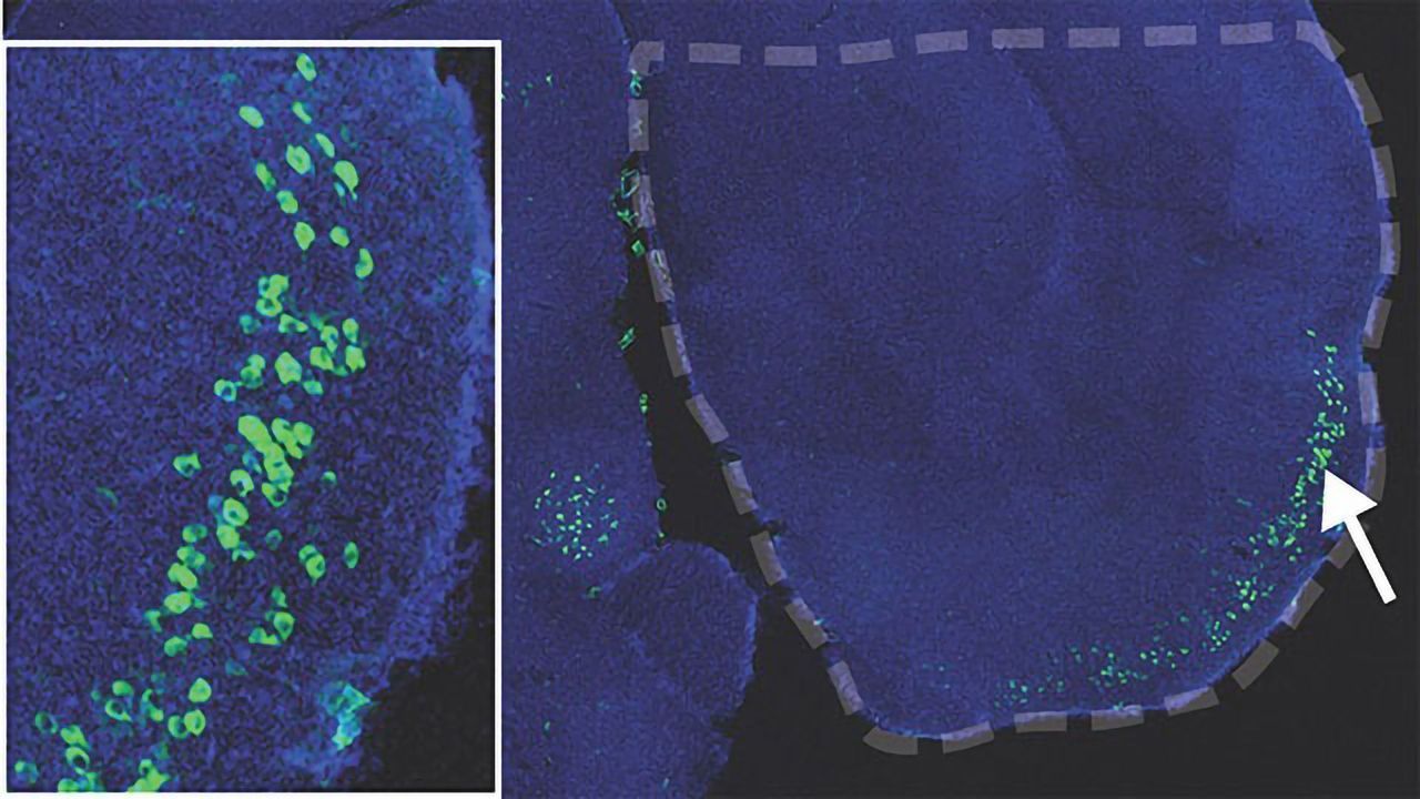 Could Neuronal Plasticity Be a Risk Factor for Alzheimer's?