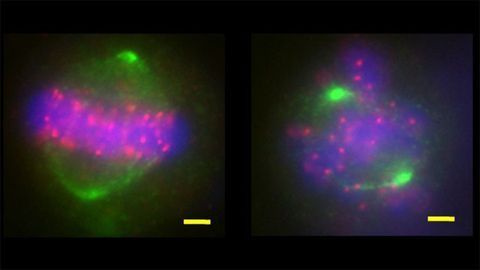 Novel Protein Complex Gets Chromosomes Organized