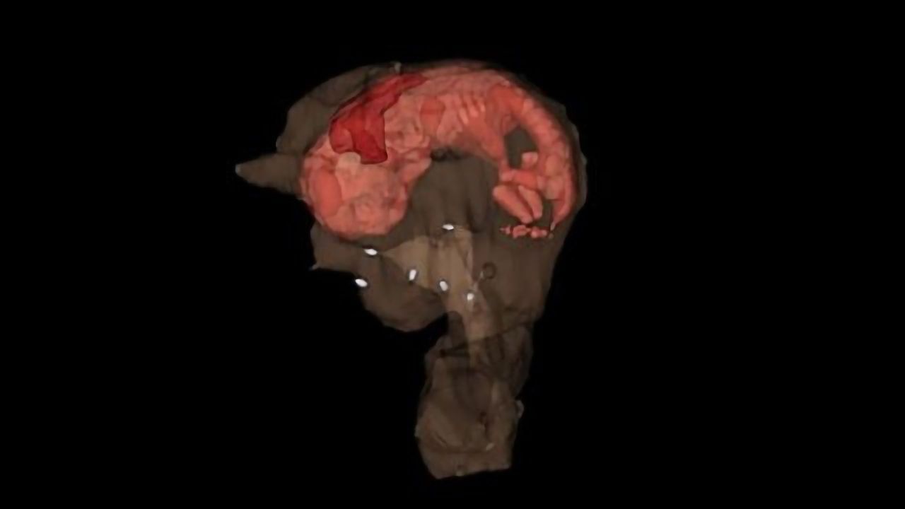 Study Shows Bioengineered Uteri Support Pregnancy in an Animal Model