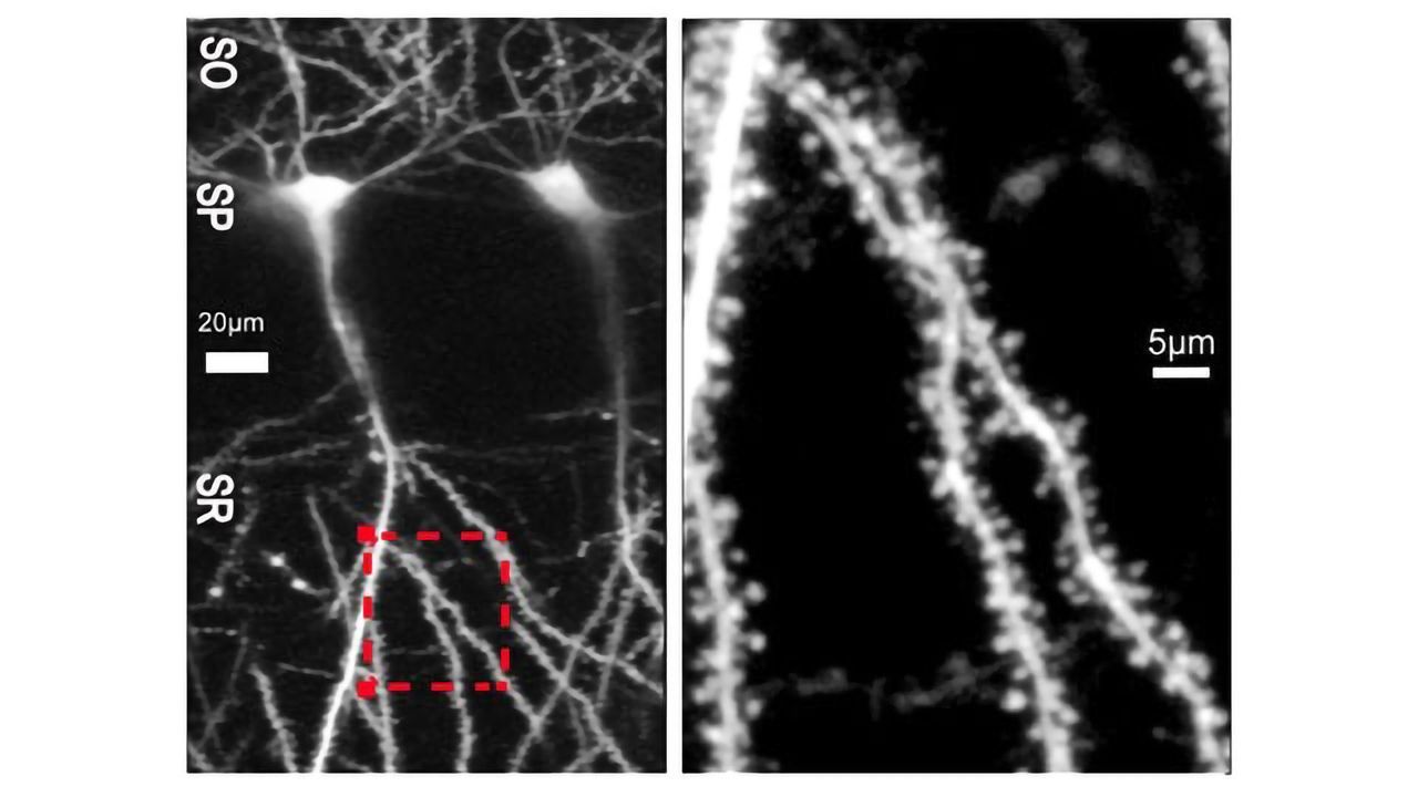 In Brain Plasticity, Size Doesn't Always Equal Strength, Suggests New Findings
