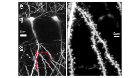In Brain Plasticity, Size Doesn't Always Equal Strength, Suggests New Findings