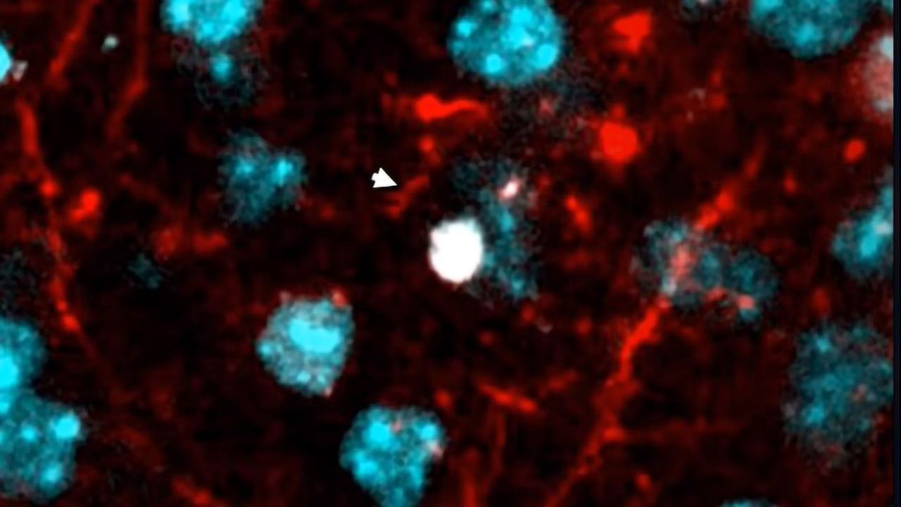 Watch What Happens When a Brain Cell Dies