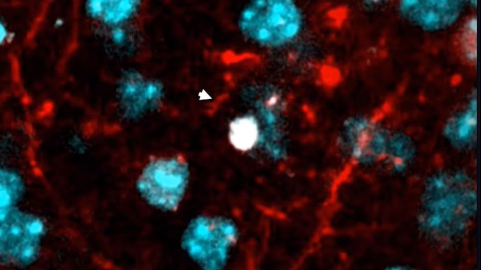 Watch What Happens When a Brain Cell Dies content piece image