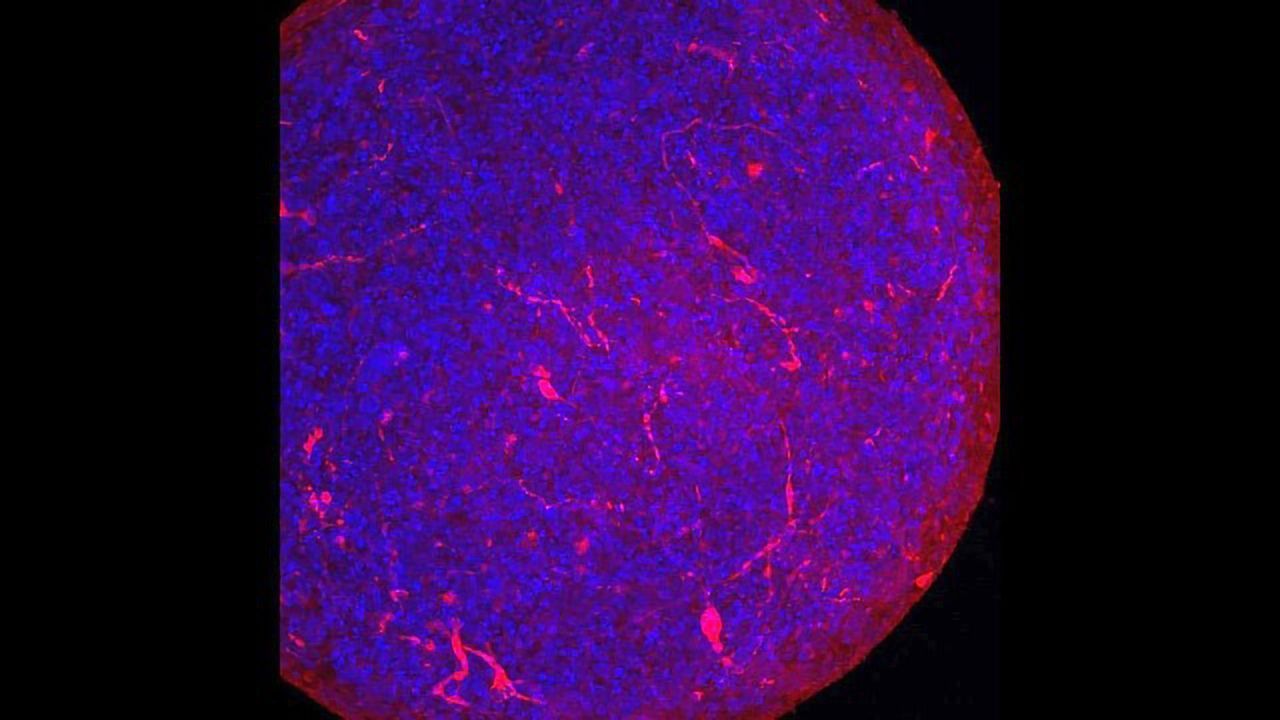 Findings From "Mini-brain" Study Suggest SARS-CoV-2 Can Infect Human Brain Cells