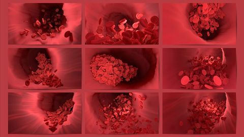 Testing Patients for Endothelial Cell Injury Could Help To Predict COVID-19 Severity