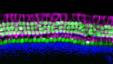 Scientists Develop New Technique To Create Sensory Hearing Cells