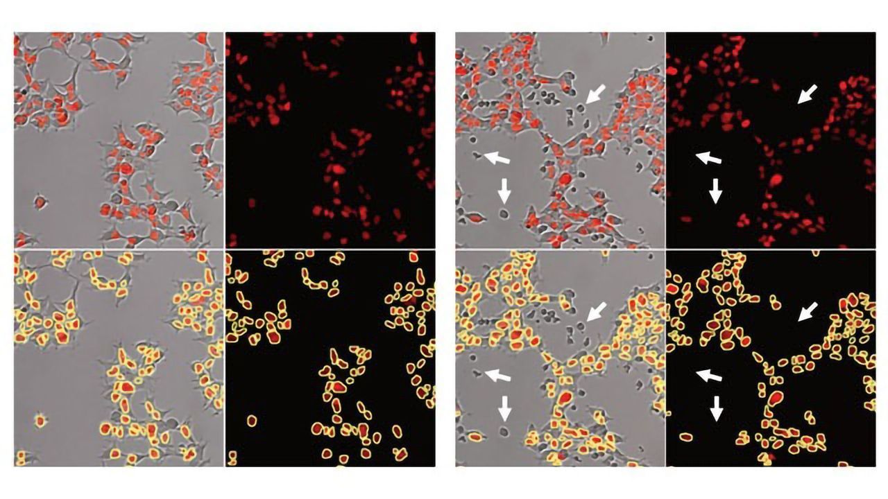 Real-Time Potency Assay for CAR T-Cell Killing of Adherent Cancer Cells